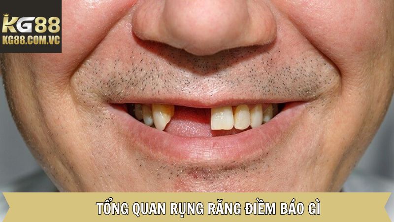 Rụng Răng Điềm Báo Gì? Giải Mã Ý Nghĩa Theo Tâm Linh Tại KG88 2 Giải thích về rụng răng điềm báo gì